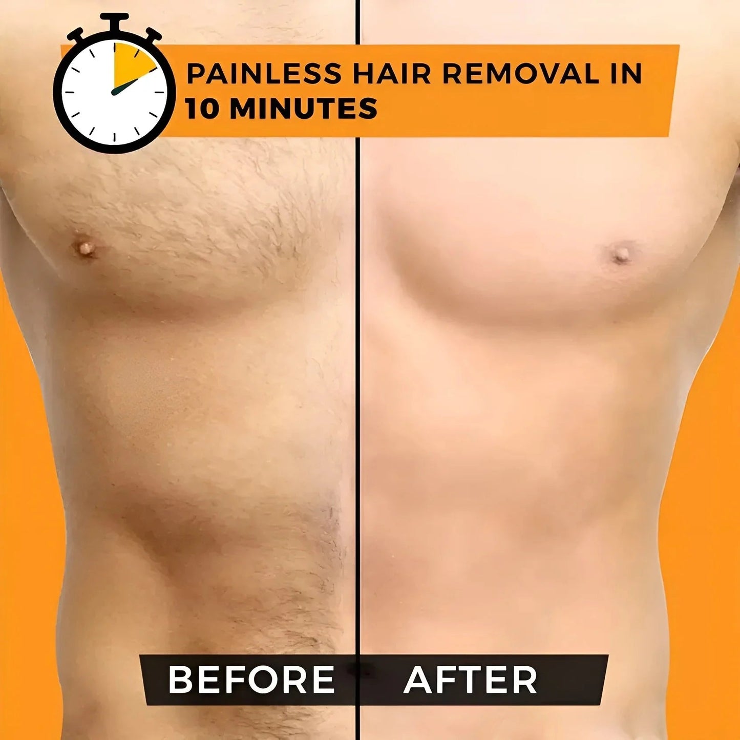 Sydonic Permanent Facial Hair Removal Treatment