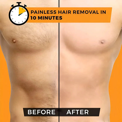 Sydonic Permanent Facial Hair Removal Treatment